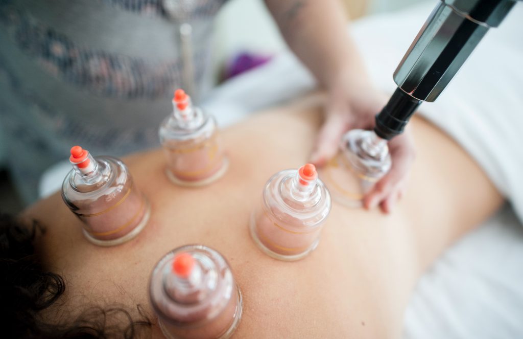Cupping Therapy in Okotoks