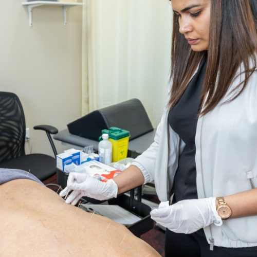 acupuncture-The-Physio-Care-Okotoks-AB